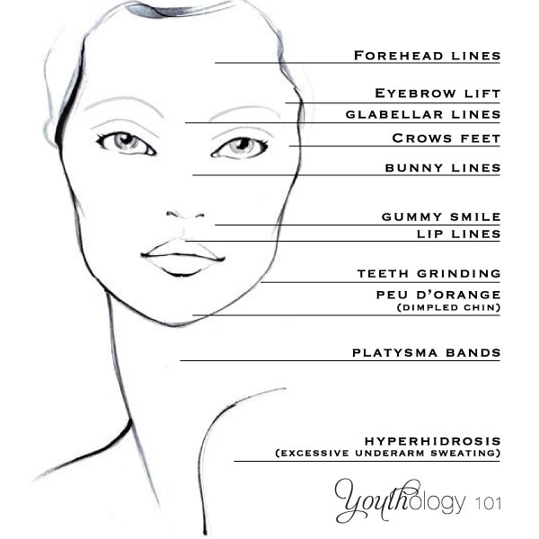 Printable Botox Charting Sheet
