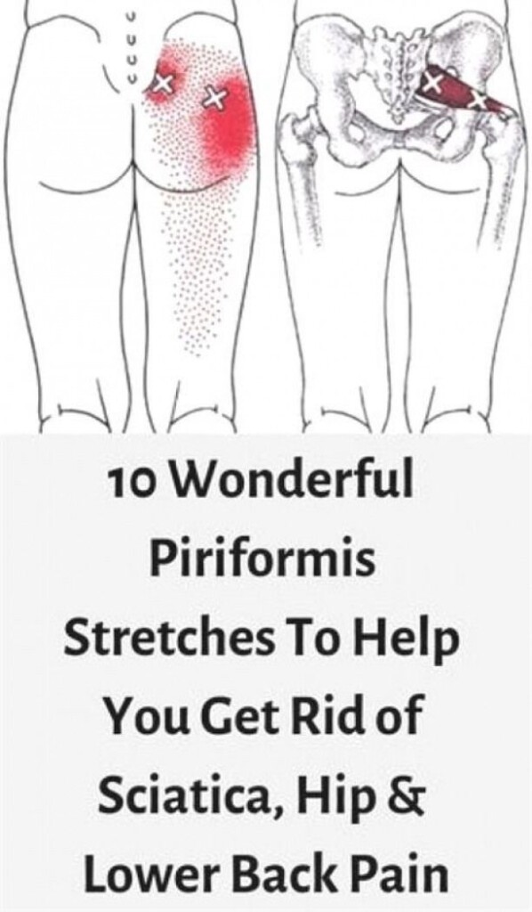 Printable Sciatica Exercise Sheet Pdf Printable Word Searches
